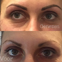 wenkbrauwen modelleren
